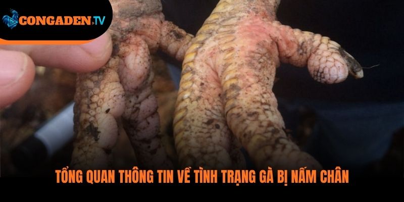 gà bị nấm chân